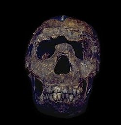 KNM WT 15000: skull, frontal view